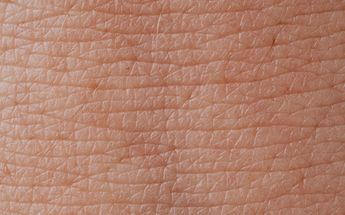 Дерматоскопія родимок – перевірка невусів у VIA Derm